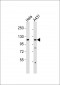 Collagen 1 alpha 2 Antibody