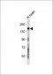 Collagen 5 alpha 3 Antibody