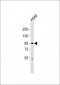 Collagen 6 alpha 2 Antibody