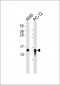 Cystatin B Antibody