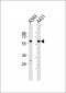 Cytochrome P450 2J2 Antibody