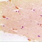 Desmin Antibody