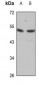 Desmin Antibody