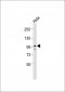 EIF4G2 Antibody