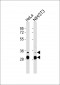 FRA2 Antibody