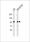 GIT1 Antibody