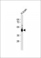 Glutamine Synthetase Antibody