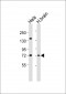 GRK6 Antibody