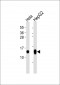 Histone H4 (AcK12) Antibody
