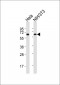 HSP60 Antibody