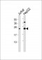 Interferon gamma Antibody