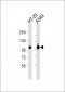 Integrin beta 5 Antibody