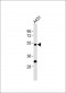 Cytokeratin 13 Antibody