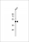 Cytokeratin 18 Antibody