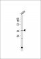 Galectin 9 Antibody