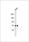 MMP15 Antibody