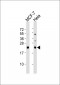 NRAS/HRAS/KRAS Antibody