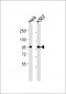 OCT1 Antibody