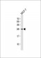 RAB20 Antibody