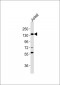 RB2 Antibody