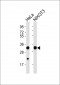 RPS2 Antibody