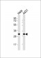 RPS4Y1 Antibody