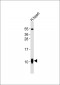 S100-A1 Antibody