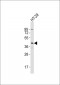 Serpin B5 Antibody