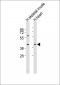 Alpha-sarcoglycan Antibody