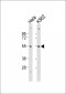 SKP2 Antibody