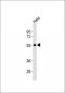 ENT1 Antibody