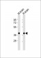 Synaptophysin Antibody