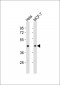 TGF beta 1 Antibody