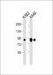 Transglutaminase 2 Antibody