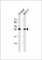 TIMP4 Antibody