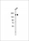 Topoisomerase 2 alpha Antibody