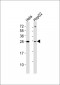 TP53INP1 Antibody