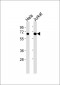 Tyrosinase Antibody