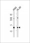 Galectin 1 Antibody