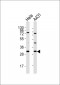 RPS4X Antibody