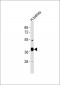 AKR1A1 Antibody