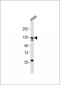 Pyruvate Carboxylase Antibody