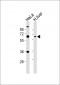 PPP2R1B Antibody