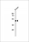 GPR41 Antibody