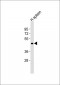 Caspase 1 Antibody