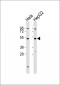 Inhibin beta A Antibody