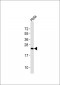 Cytoglobin Antibody