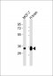 EB3 Antibody