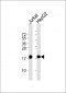 EIF5A Antibody