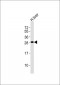 GSTM1 Antibody